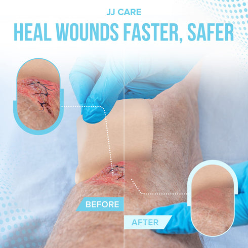 JJ CARE Hydrocolloid Dressing (Pack 10) - 4x4 Hydrocolloid Bandages with Border